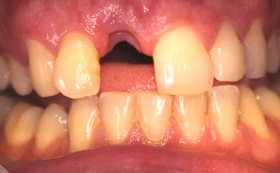 101after