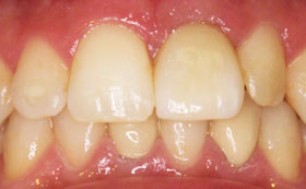 10before