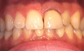 10after