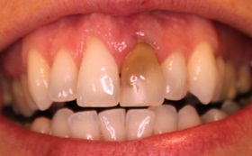 12after