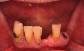 6after