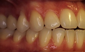 7before