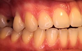 7after