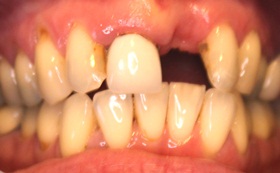 91after