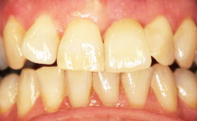 9before