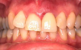 9after