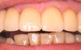 Asmile design before