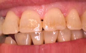 Asmile design after